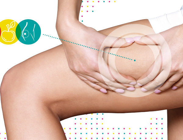 Mesoterapia e Cellulite